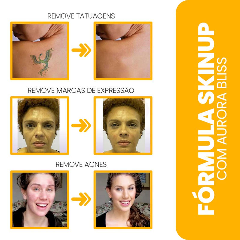 Base Aurora Bliss Remove Manchas e Expressões + Brinde: Esponja Profissional Base Aurora Bliss® Remove Manchas e Expressões KITO MAGAZINE 